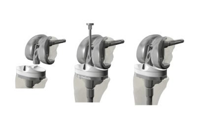 Mecanismo sem tensão