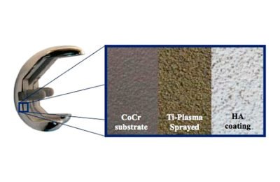 Componente Femoral sem Cimento