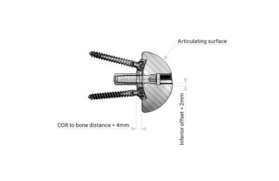 Melhorias na Configuração Reversa