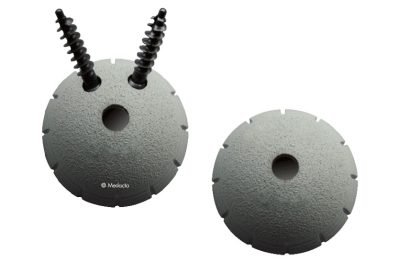 Parafusos e Acessórios